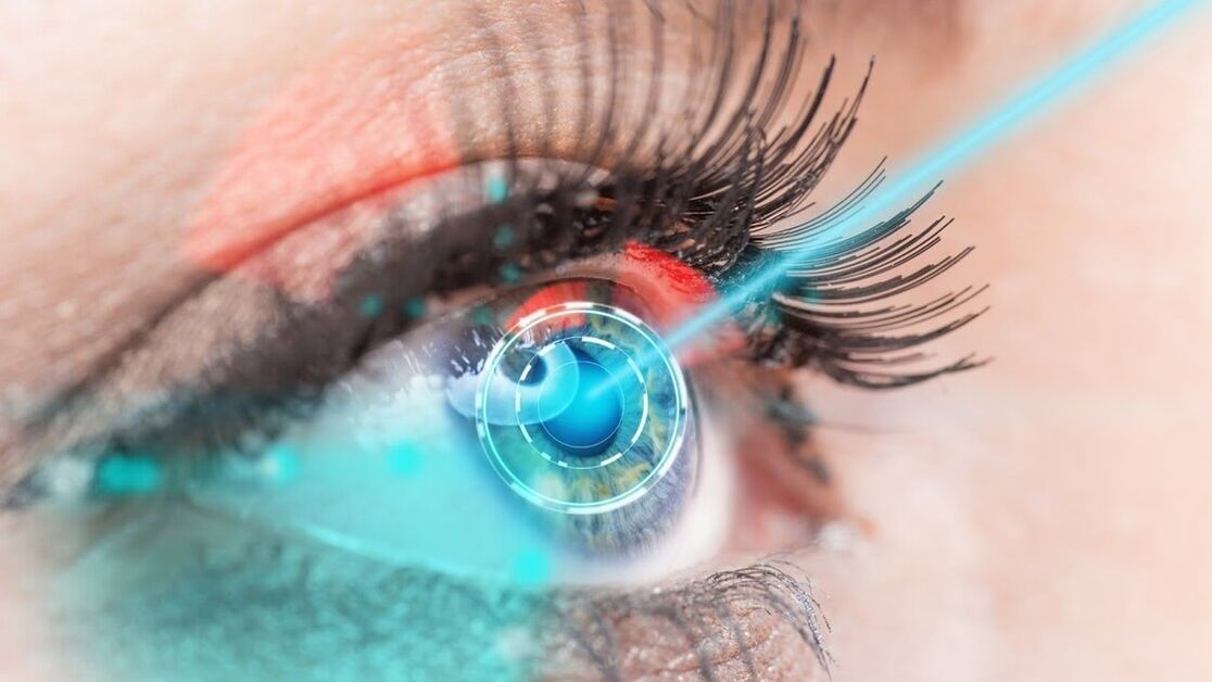 Restore vision using laser correction